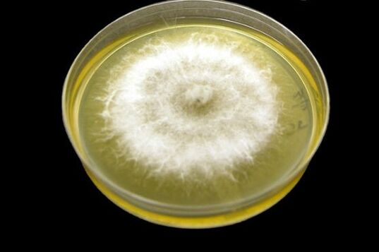 How to get rid of the mold of the nails