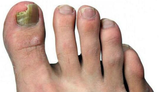 Nail lubrication