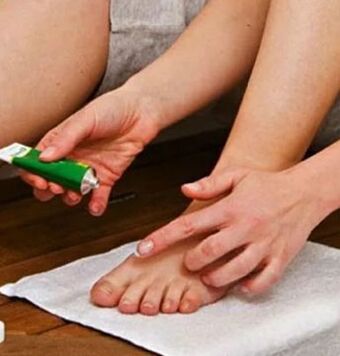 The use of therapeutic ointment for the defeat of the big toe with fungus